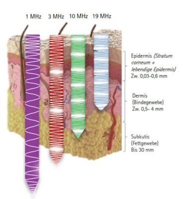 Depths of penetration of different Ultrasound frequencies