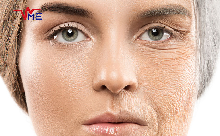 chieve Ageless Skin Cutting-Edge Wrinkle Solutions