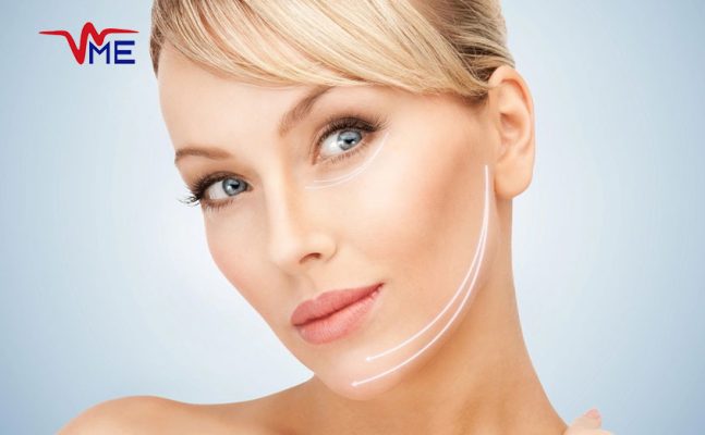 Non-surgical laser facelift