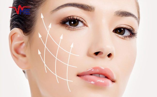 Non-surgical laser facelift