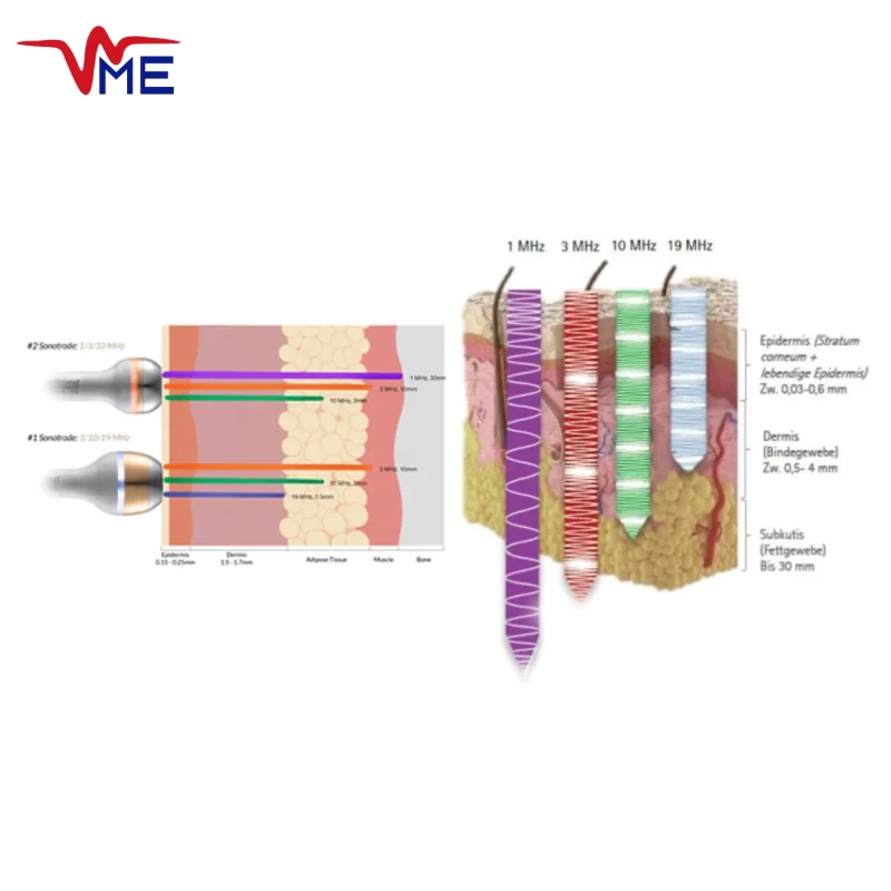 Why 10Mhz is best for Skincare