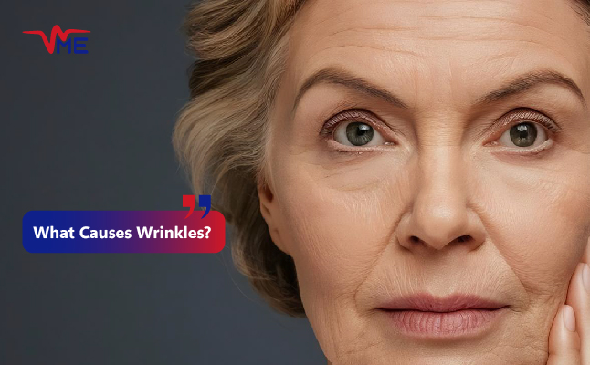 Treating Wrinkles with Skinova