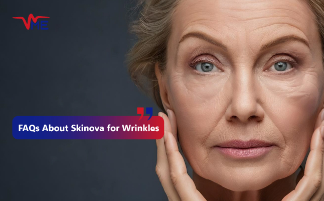 Treating Wrinkles with Skinova